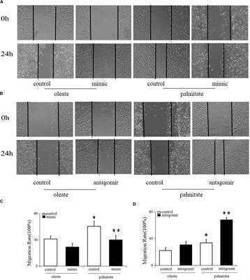 MicroRNA-126 Modulates Palmitate-Induced Migration in HUVECs by Downregulating Myosin Light Chain Kinase via the ERK/MAPK Pathway